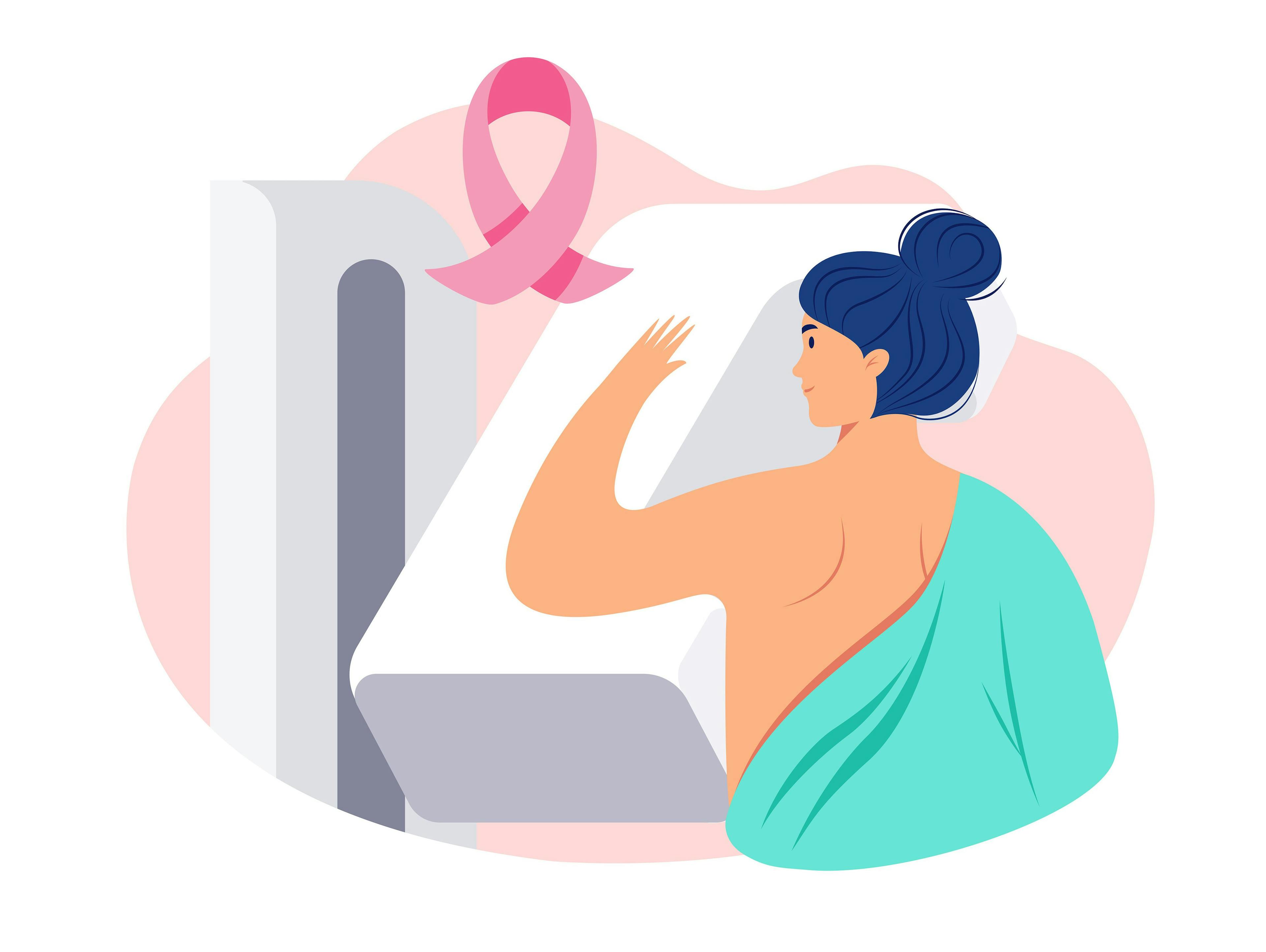 Illustration of woman getting mammogram | Image Credit: forestgraphic - stock.adobe.com
