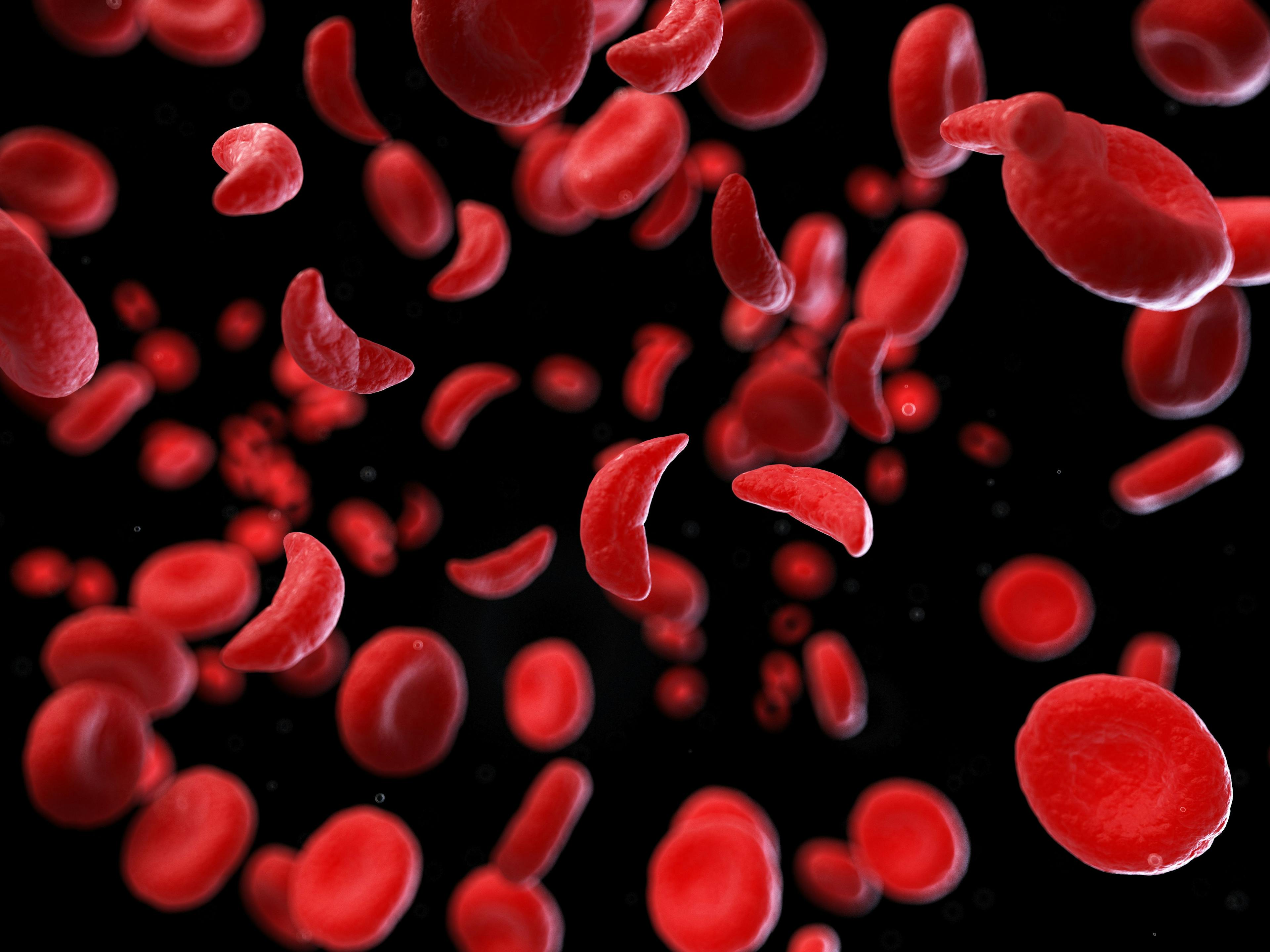 Model of Sickled Cells | image credit: Sebastian Kaulitzki - stock.adobe.com