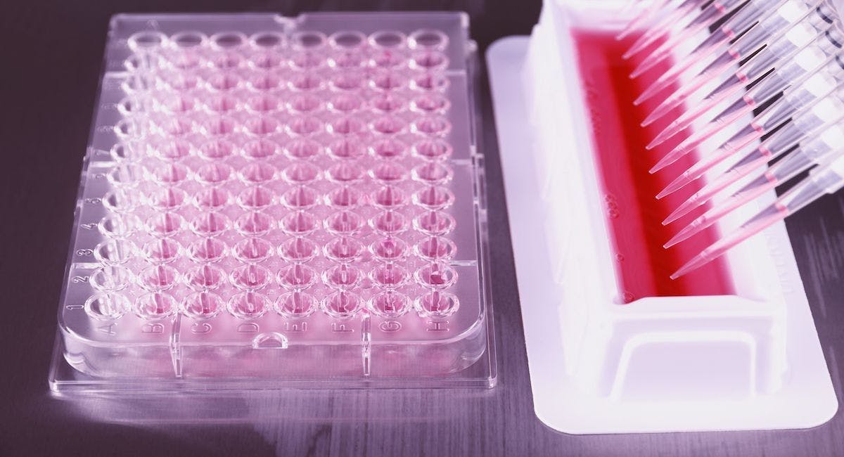 Image of PCR test being performed