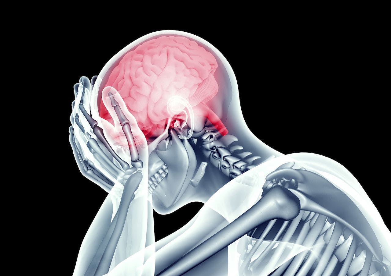 Study Describes Use of Occipital Nerve Stimulation to Treat Refractory Headaches