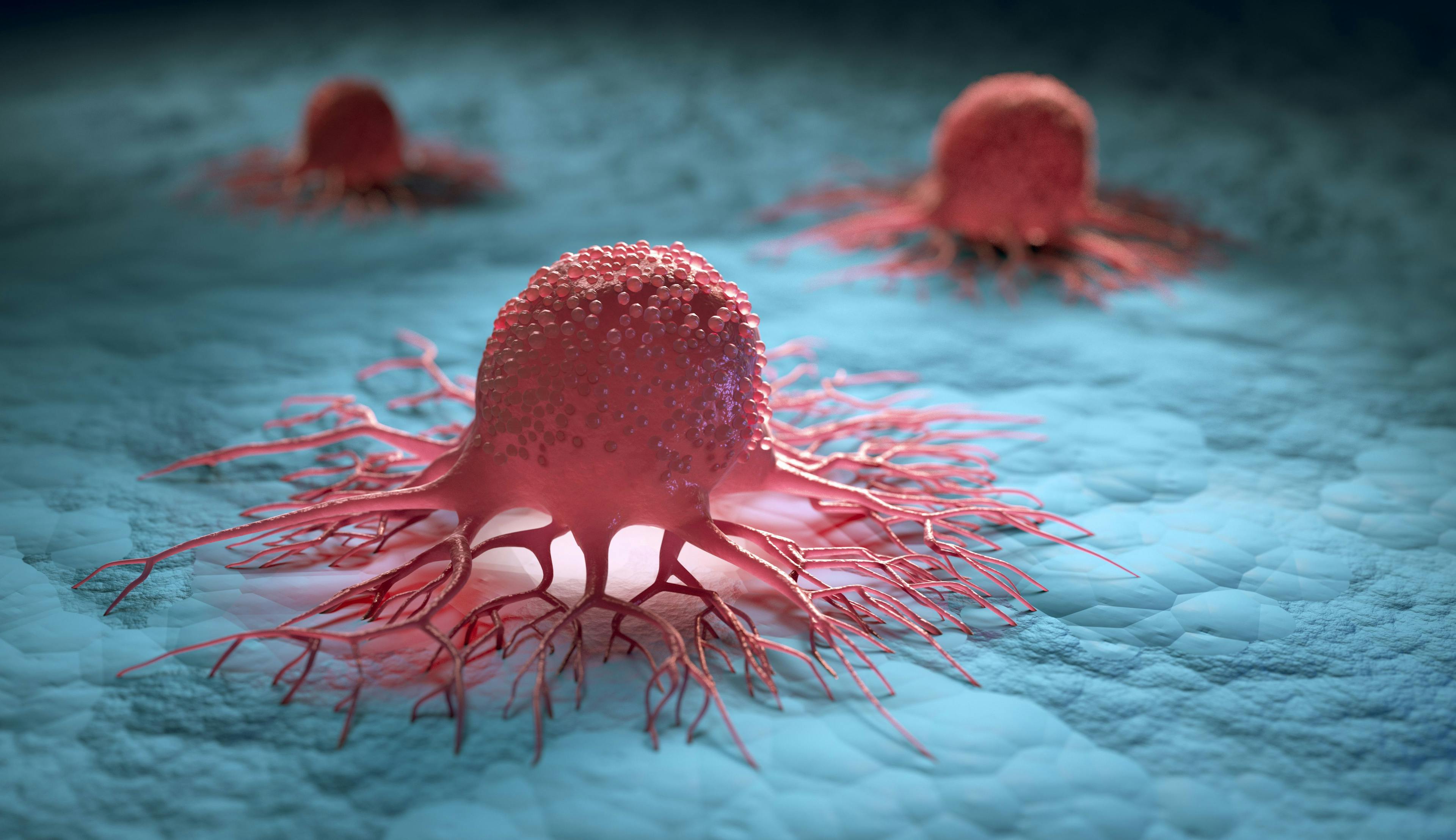 Study Examines Impact of Tumor Mutational Burden on Ovarian Cancer 