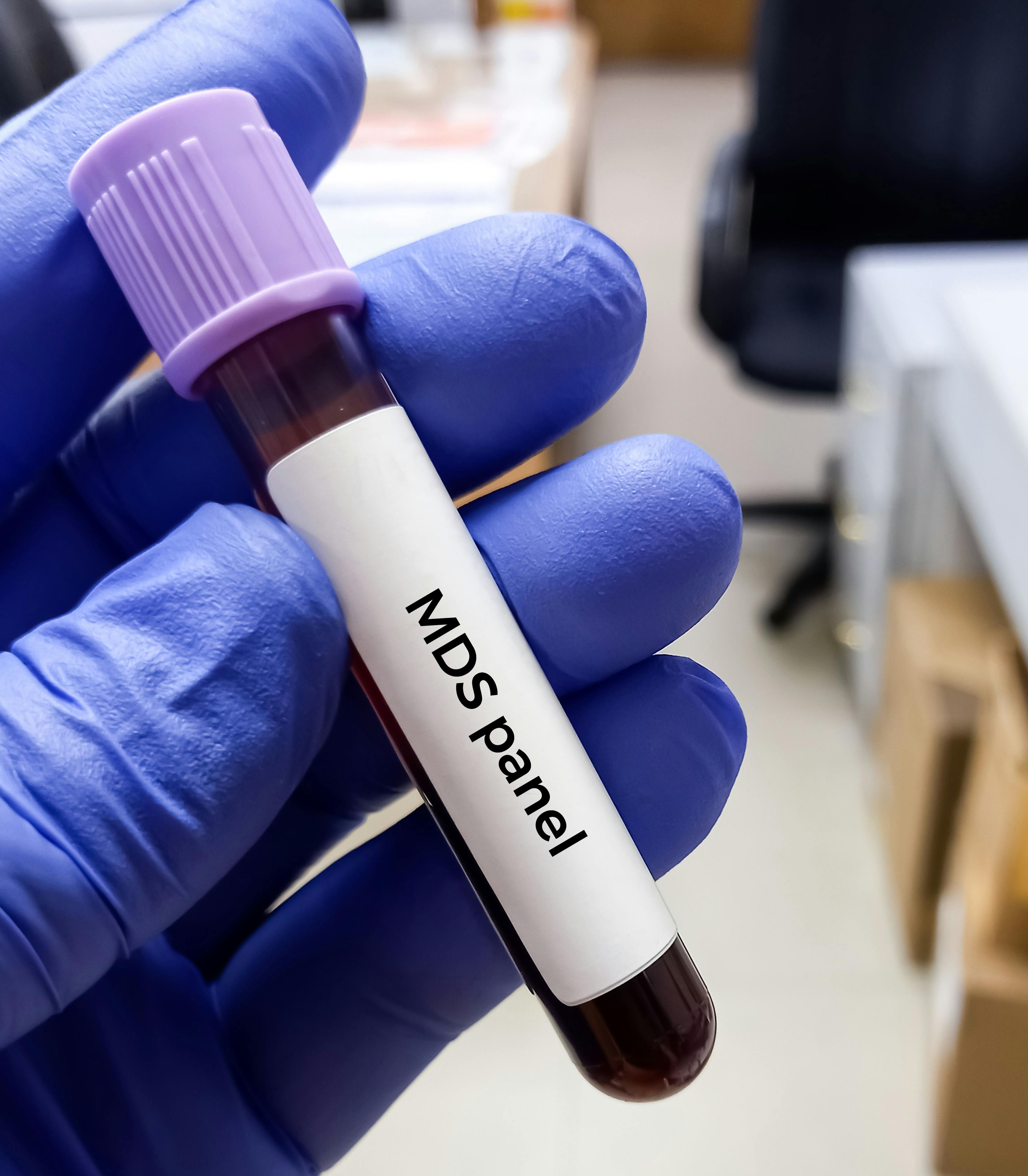 Blood sample for MDS test | Image credit: MdBabul - stock.adobe.com