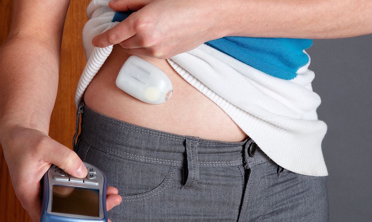 Bringing Greater Context to Precision Monitoring in Patients With Diabetes