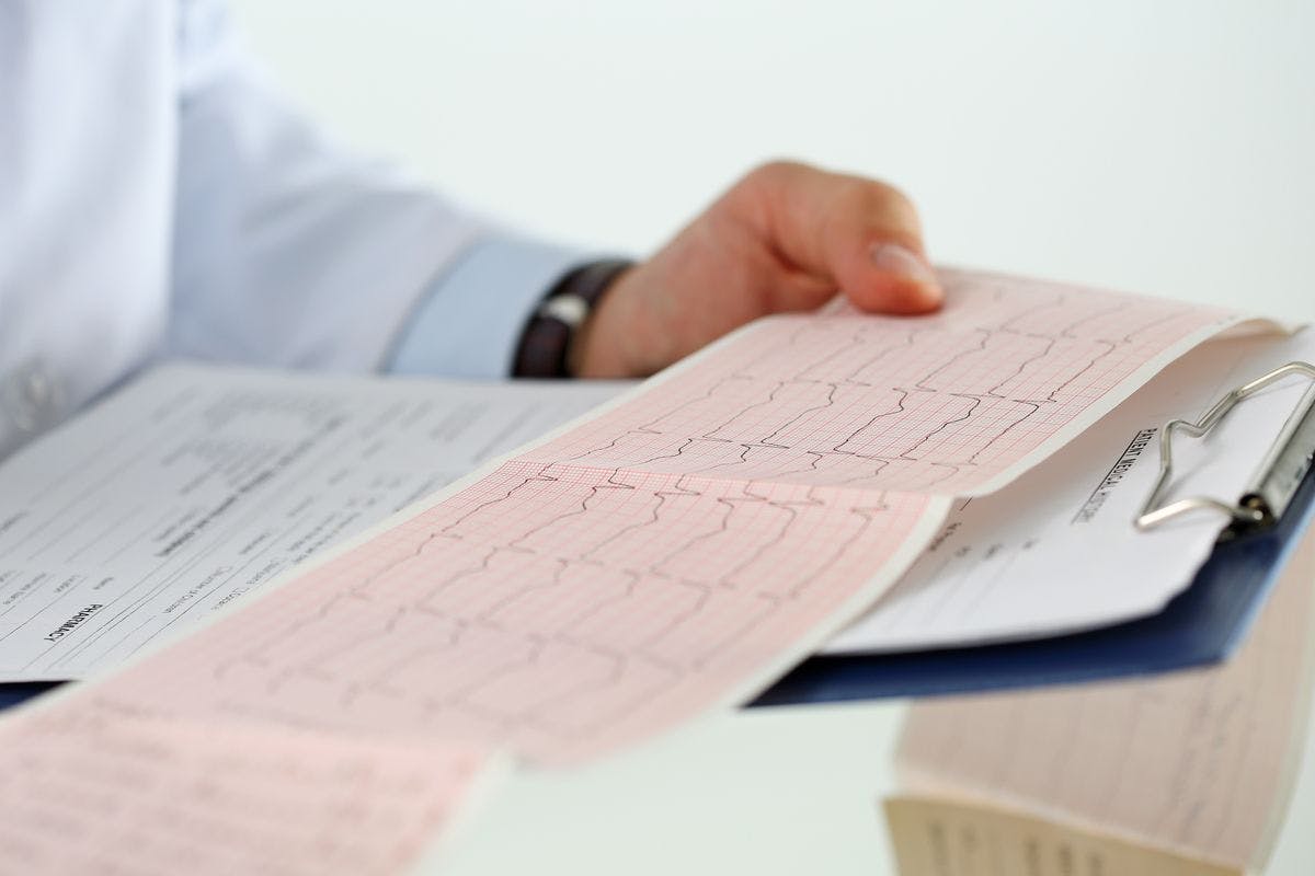 Clinician examining cardiac function results