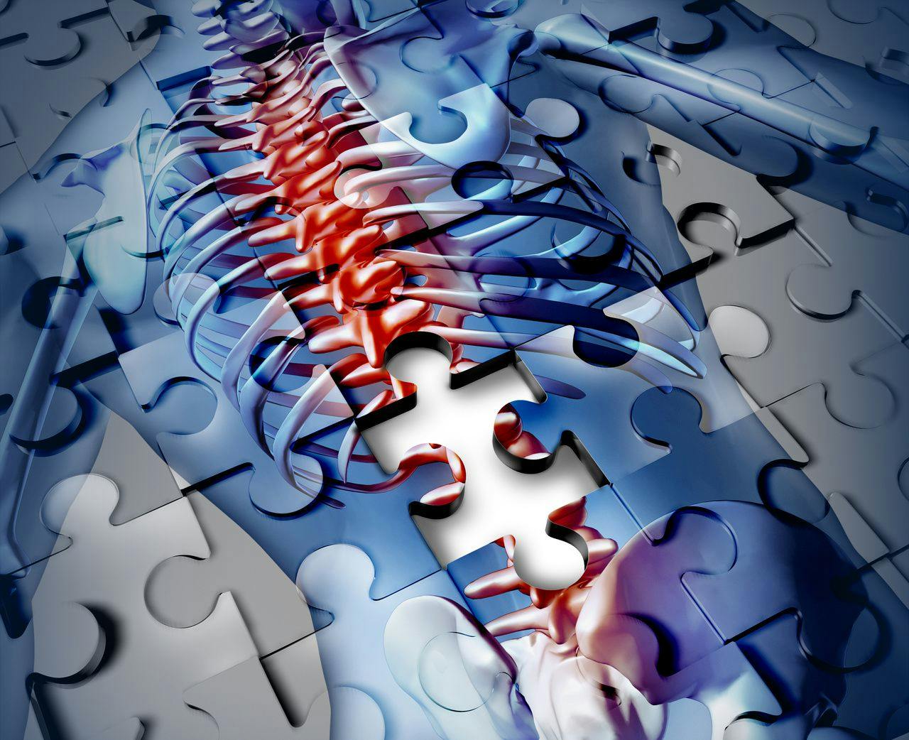 Puzzle-piece picture of spinal column