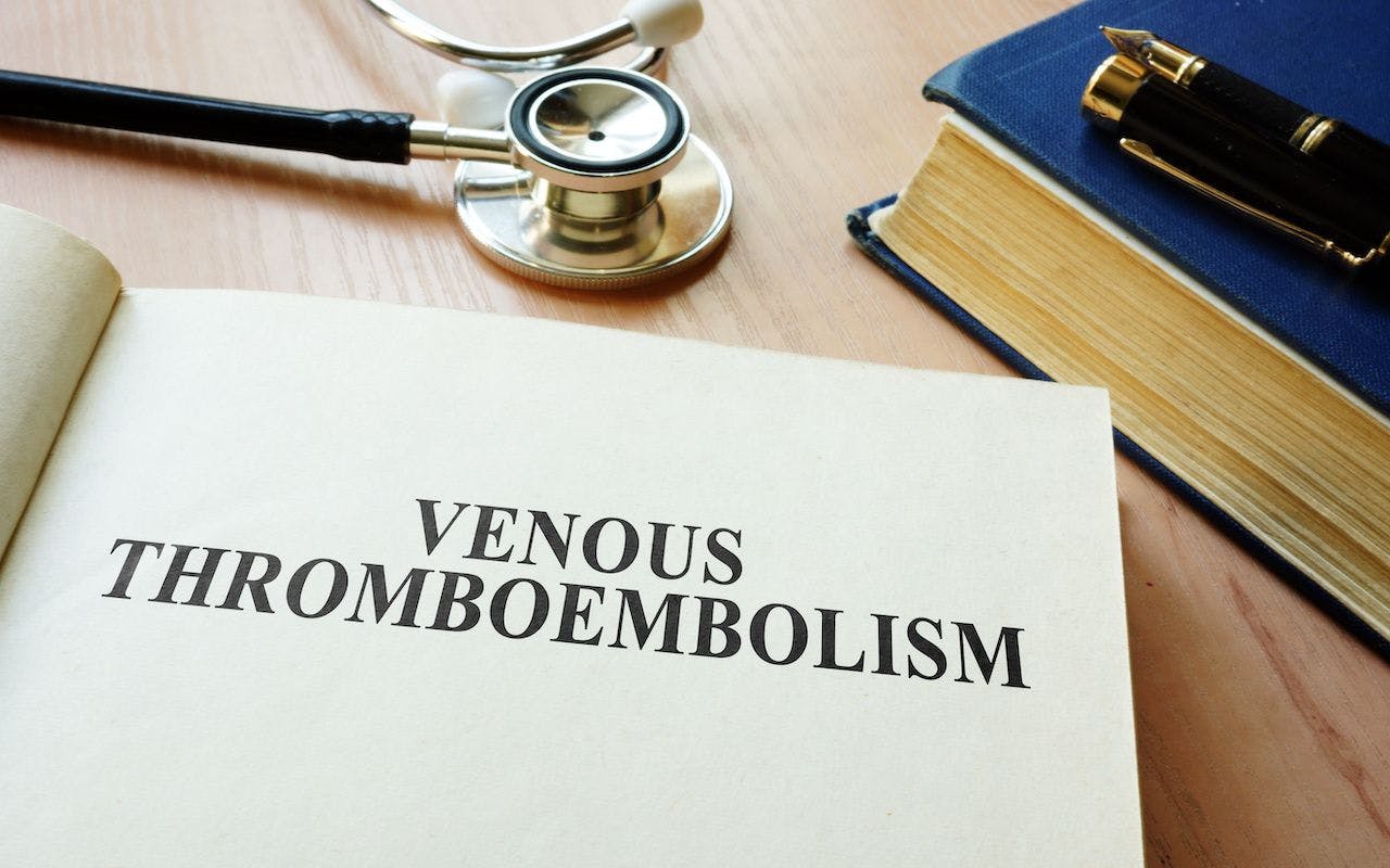 Book with title Venous thromboembolism VTE: © Vitalii Vodolazskyi - stock.adobe.com
