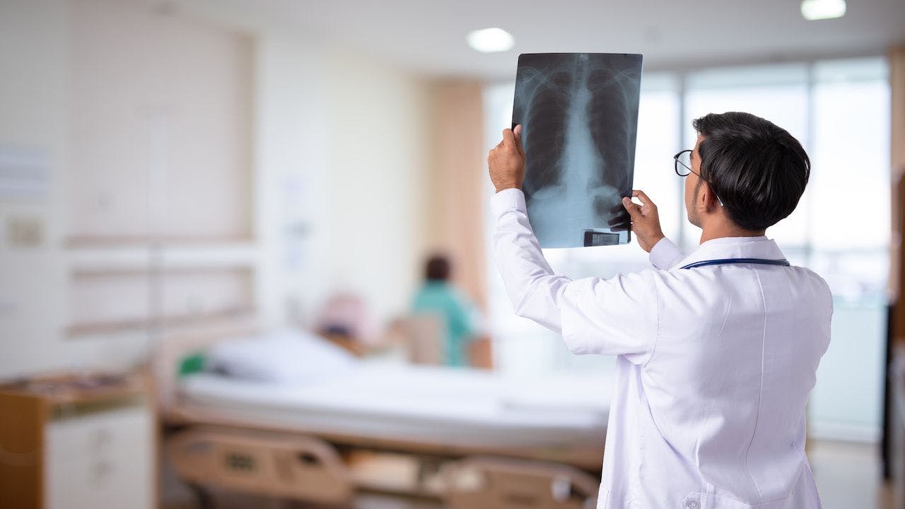 Non–small cell lung cancer is the most common type of lung cancer, which is the leading cause of cancer death worldwide.

Image credit: pakorn - stock.adobe.com