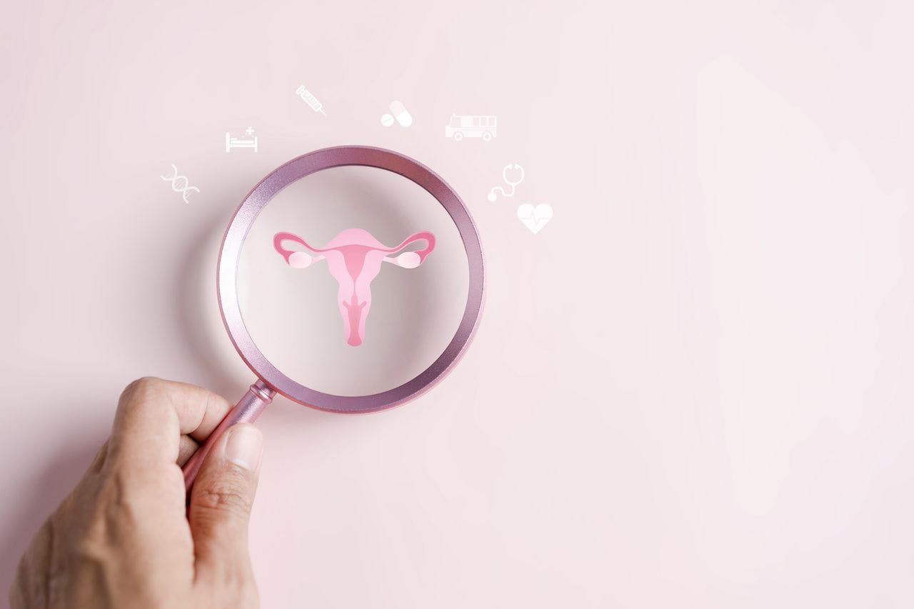 Checkup uterus reproductive system , women's health, PCOS, ovary cancer treatment and examine, Healthy feminine concept: © Kiattisak - stock.adobe.com