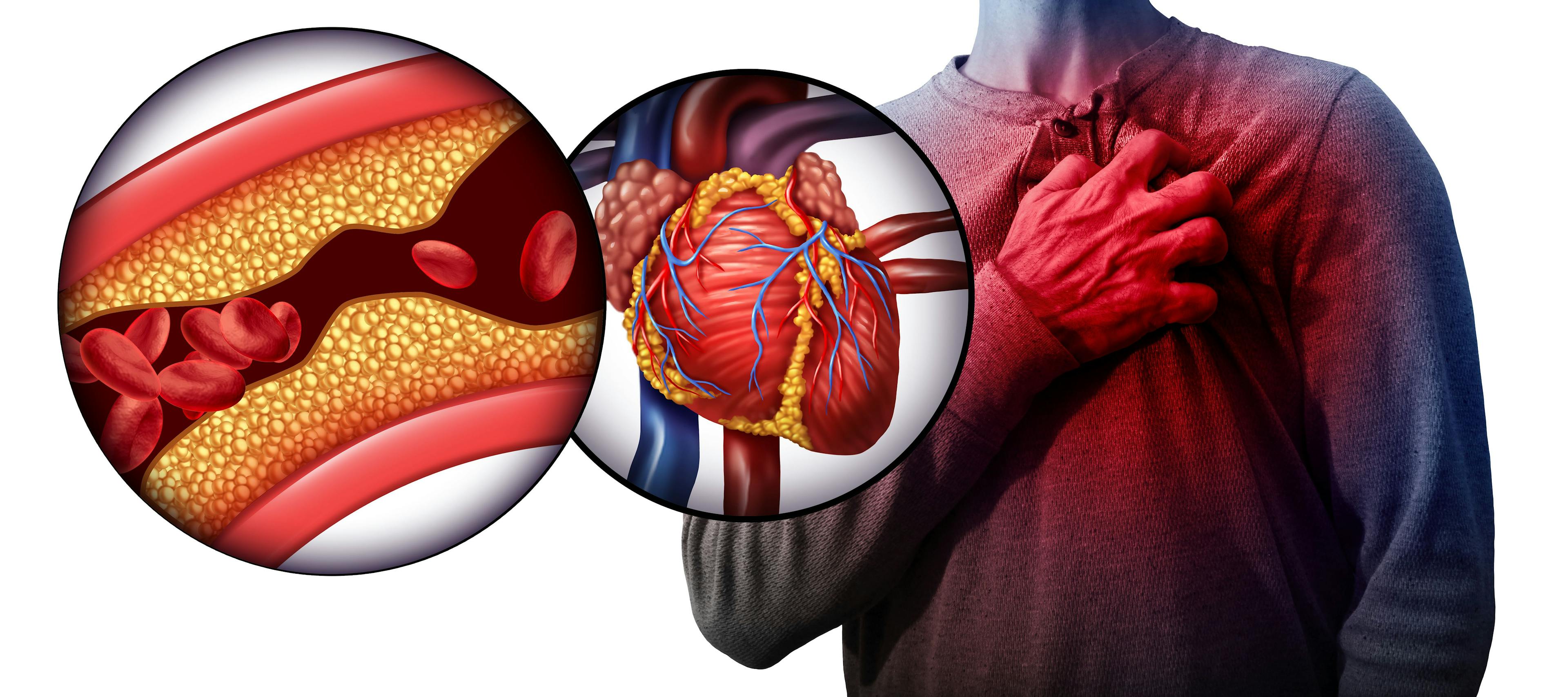 Hypertension Model, Cardiometabolic Risk | image credit: freshidea - stock.adobe.com