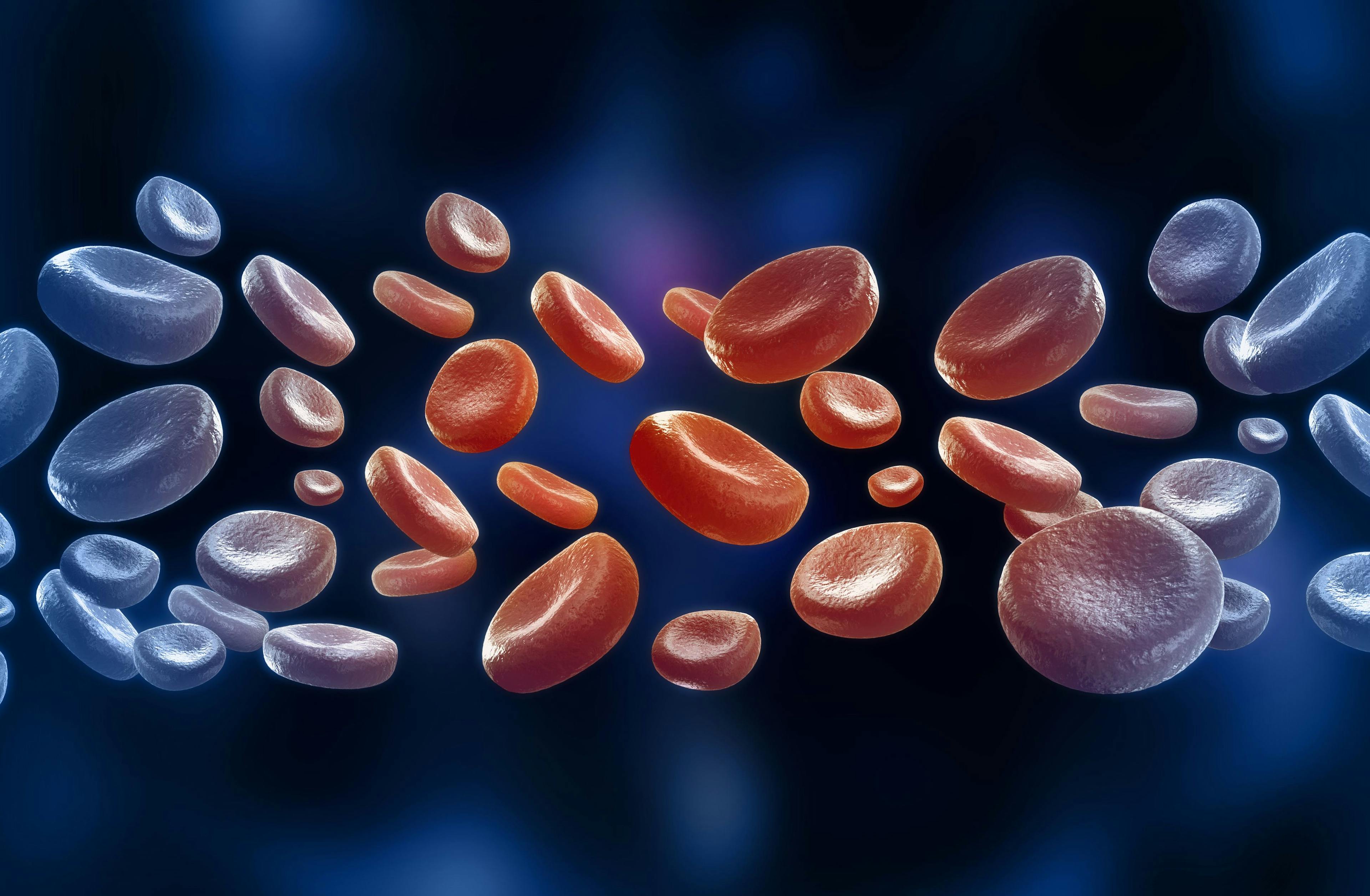 Study Explores Risk Factors for Therapy-Related MDS, AML Following HCT for Multiple Myeloma