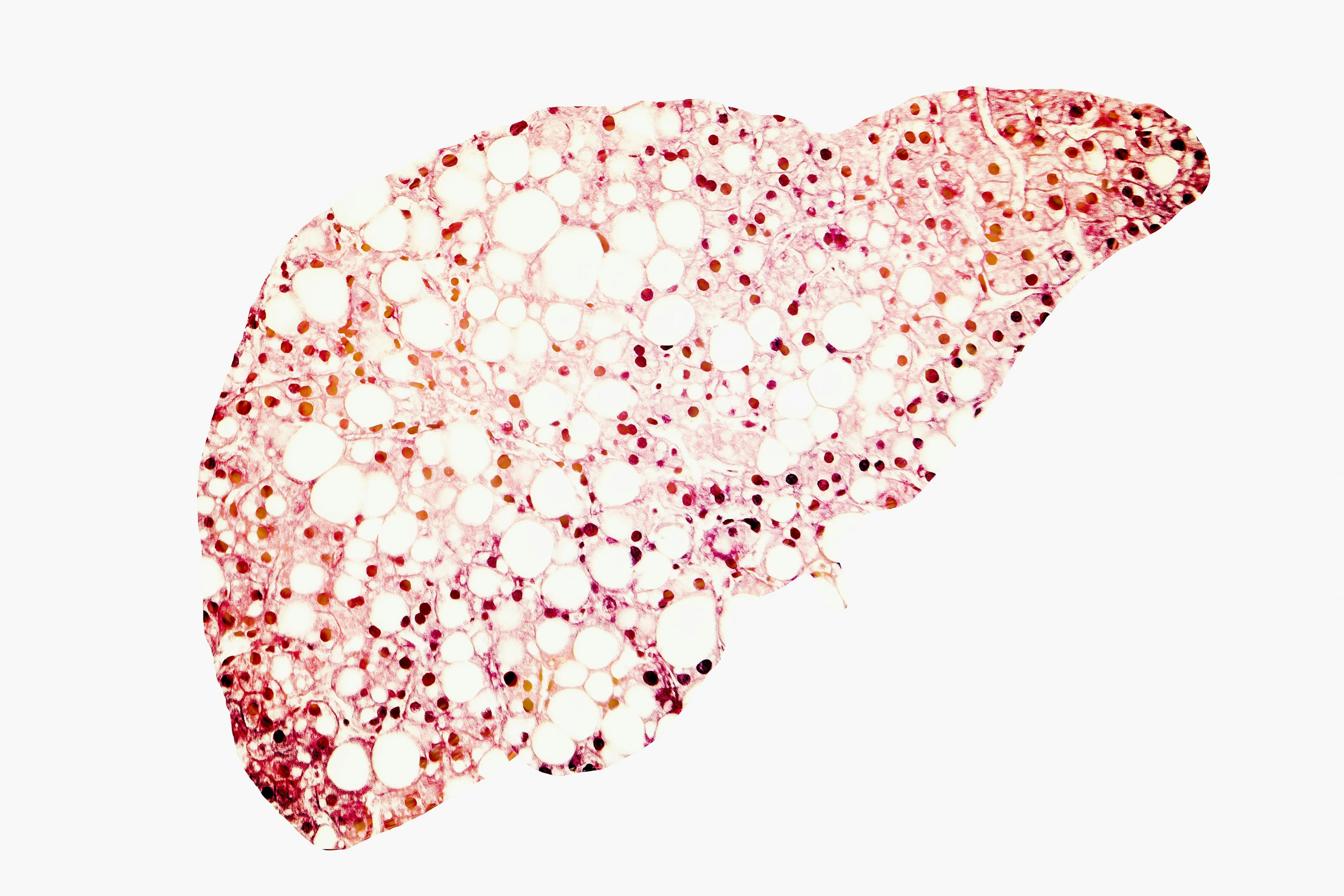 graphic of liver