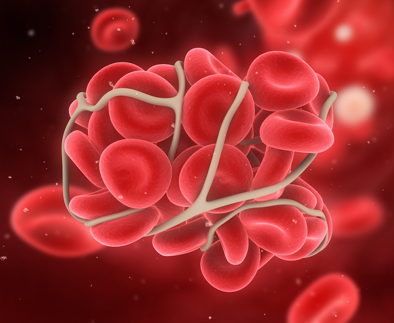 Systematic Review Finds Elevated Reporting for Thromboembolic Events With JAK Inhibitors