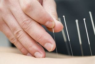 Acupuncture May Be Effective Nonopioid Treatment for Pain in the VA