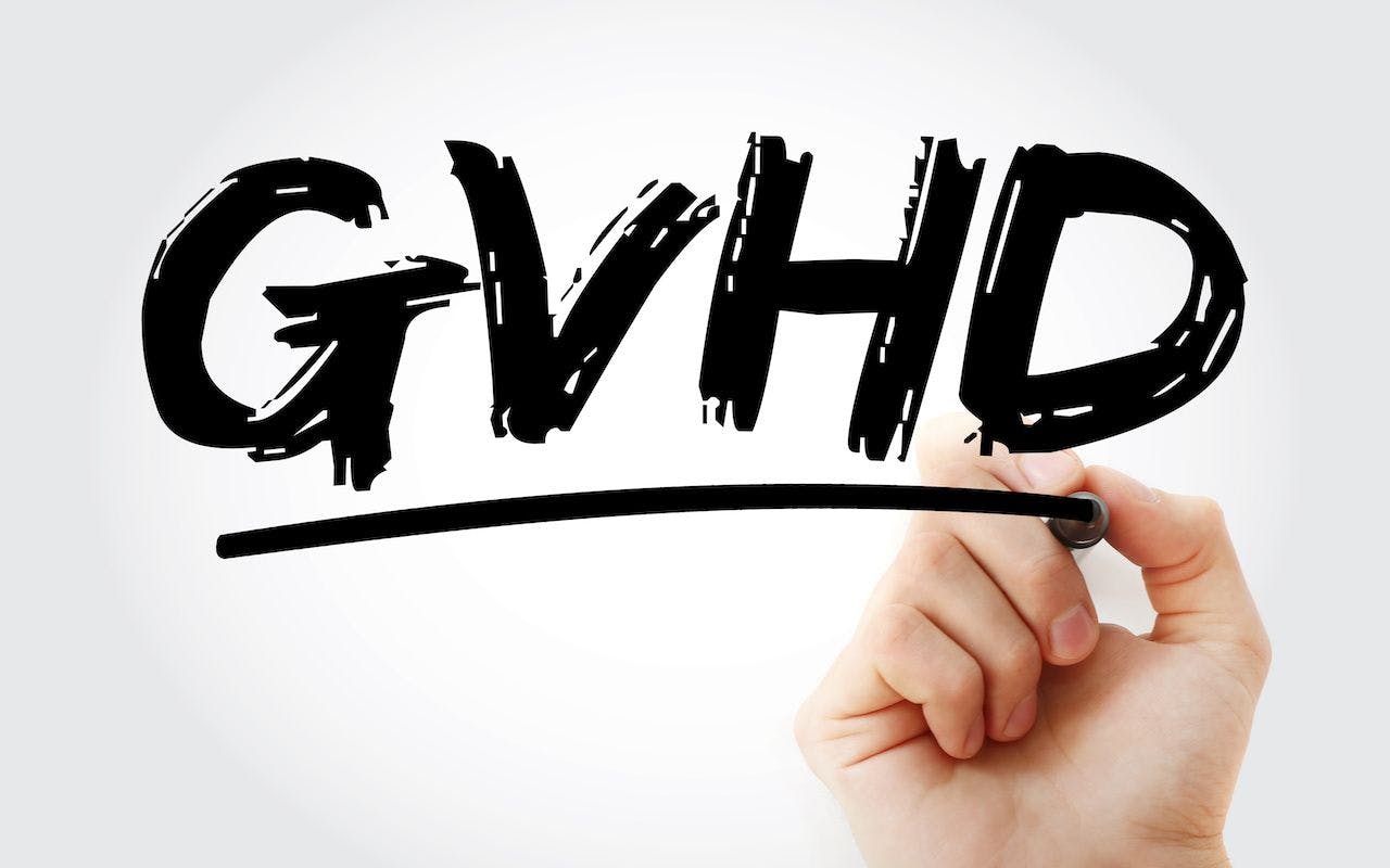 GVHD - Graft-versus-host disease acronym with marker, concept background: © dizain - stock.adobe.com