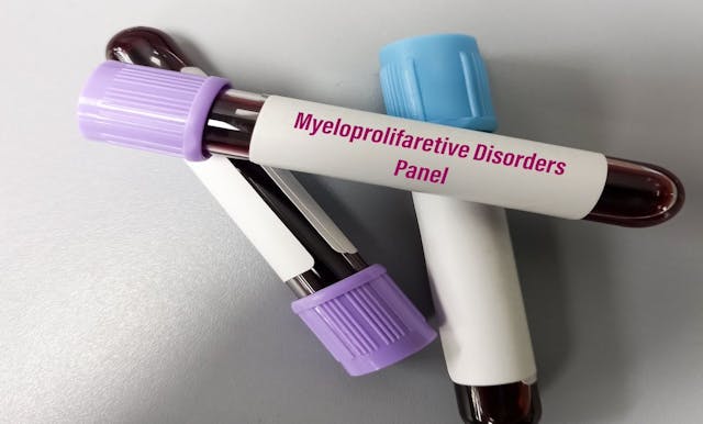 Blood sample for Myeloproliferative disorders panel | Image Credit: MdBabul - stock.adobe.com