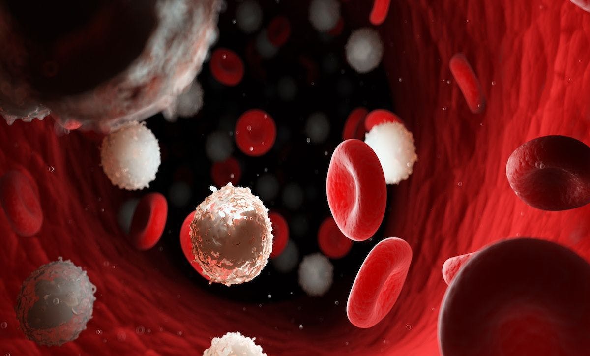 Too many white blood cells due to leukemia | Image credit: Sebastian Kaulitzki-stock.adobe.com