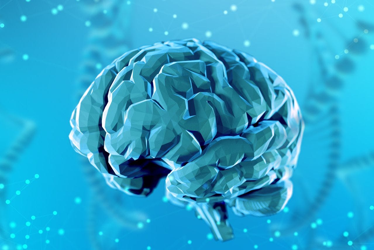 MRIs Find Abnormalities in Central Vestibular Cortex of Some Patients With Migraine