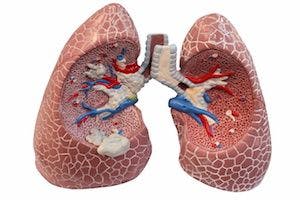 Mayo Clinic Report Suggests Changes to Next COPD GOLD Update