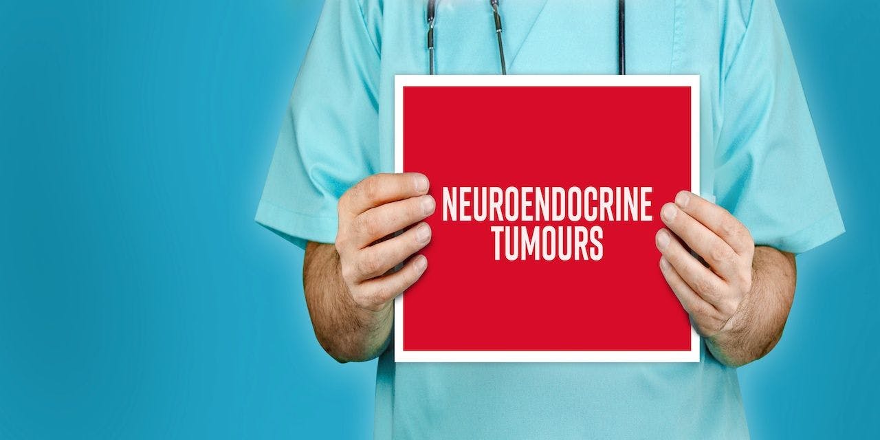 Neuroendocrine tumours. Doctor shows red sign with medical word on it. Blue background: © MQ-Illustrations - stock.adobe.com