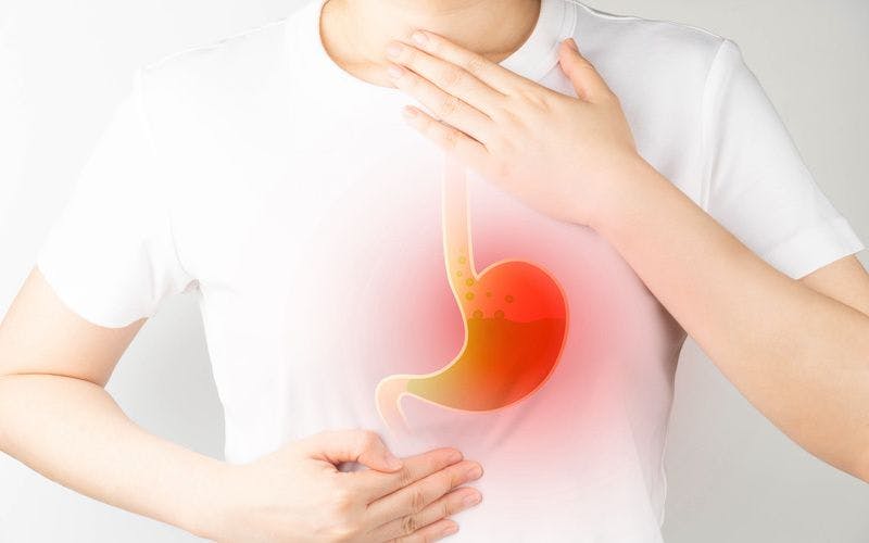 Gastroesophageal reflux disease (GERD) or acid reflux symptoms. Woman suffering from heartburn, stomachache, nausea and bloating. Gastrointestinal system disease and digestive problems: © Orawan - stock.adobe.com