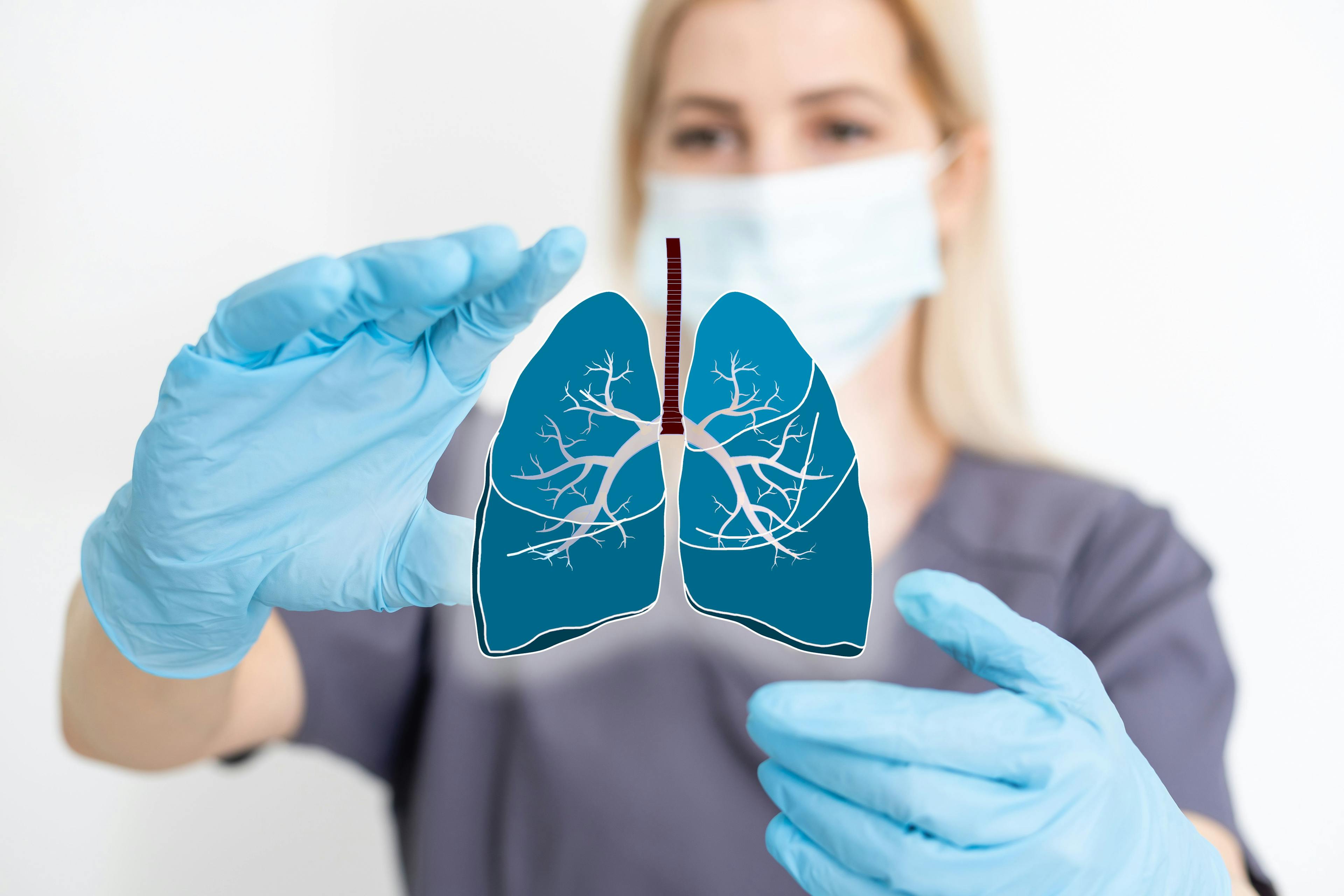 Clinician Framing Lung Concept | Image credit: Angelov - stock.adobe.com