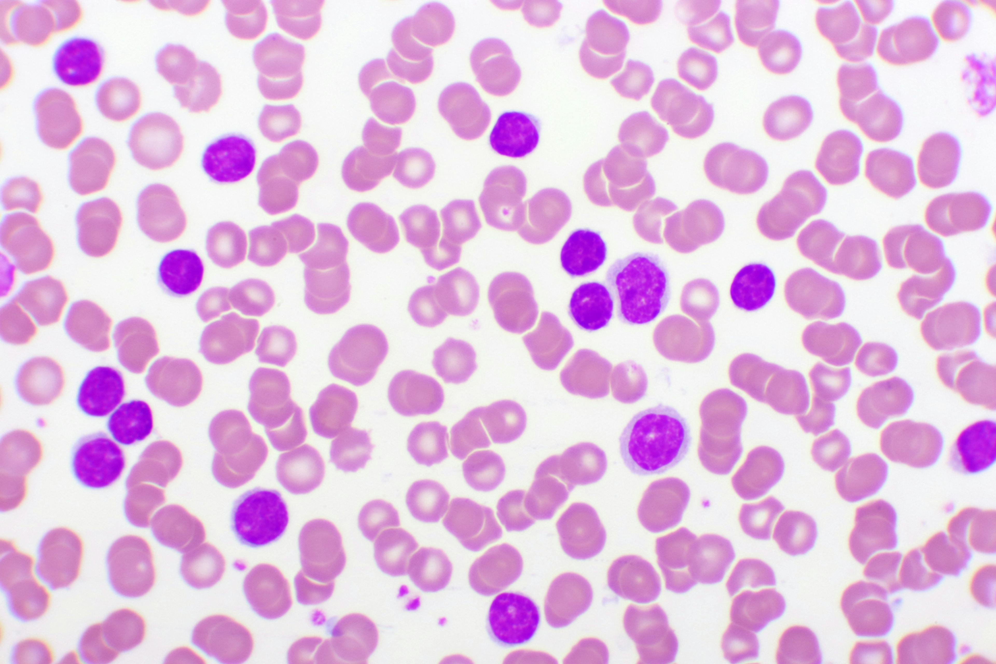Blood eosinophil cells