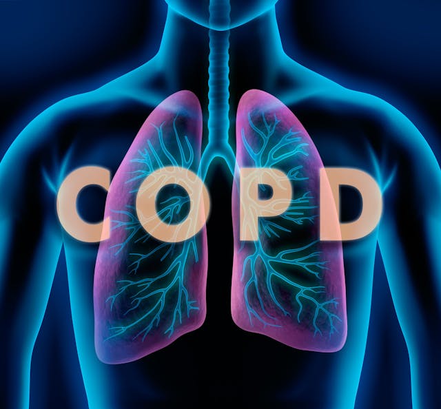 COPD | Image Credit: peterschreiber.media - stock.adobe.com