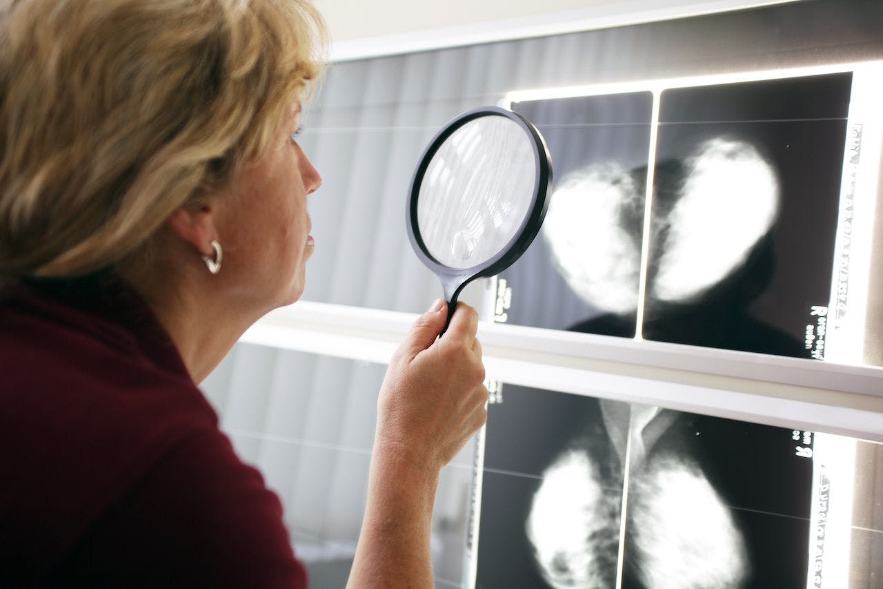 Image of a mammography review