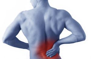 Study Suggests Policy Terms for Nondrug Treatments for Low Back Pain Are Inconsistent