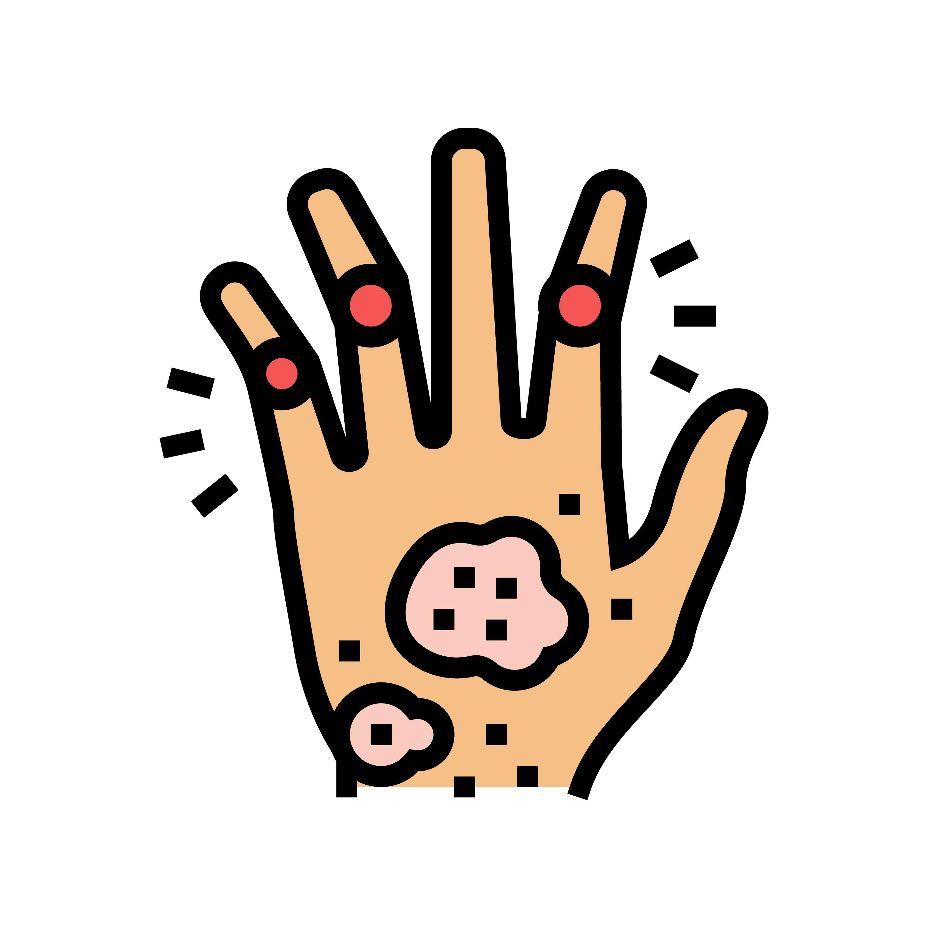 psoriatic arthritis hand illustration | vectorwin - stock.adobe.com