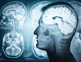Health Claims Study Suggests Link Between Parkinson Disease and TMD