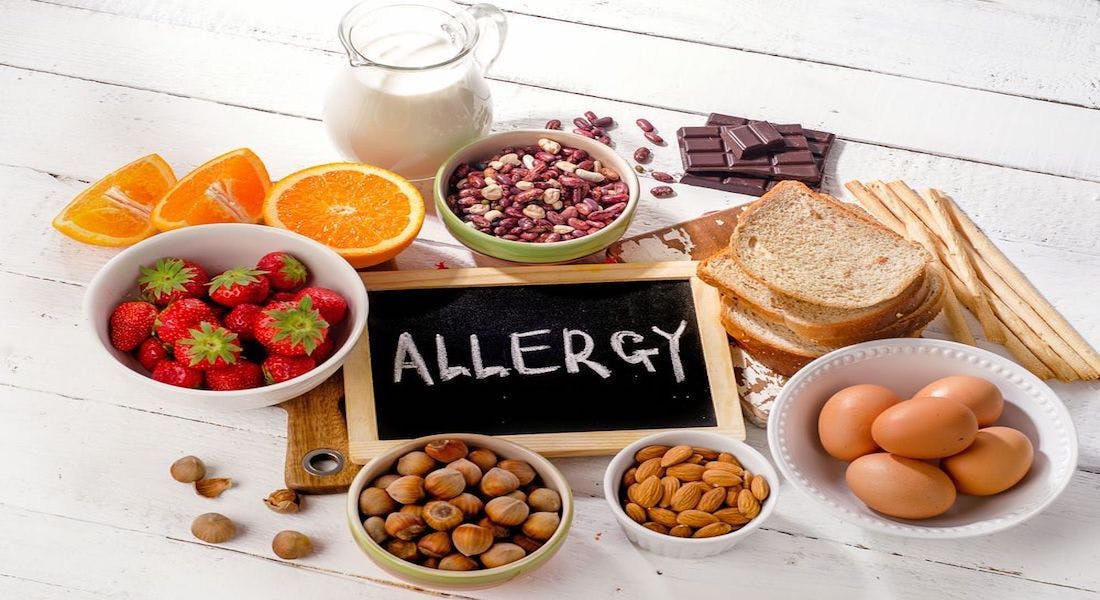 Image of food with an allergy sign