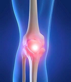 Study Measures Cost, Patient Outcomes After Total Knee Replacement