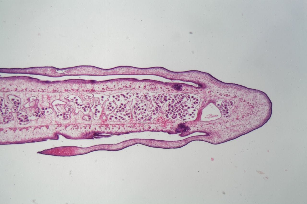 Image of a tapeworm