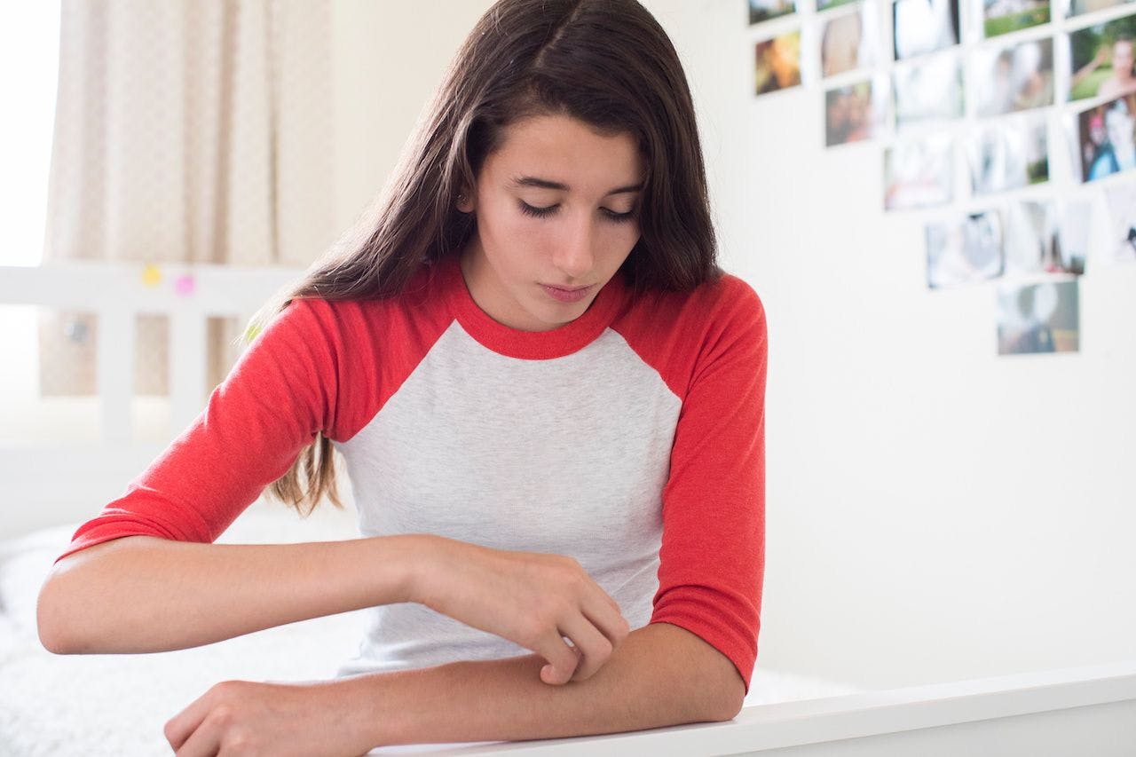 Teenage Girl Sitting In Bedroom Scratching Arm: © Daisy Daisy - stock.adobe.com