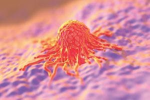 Switchable CAR T Cells May Be Safer in Pancreatic Cancer