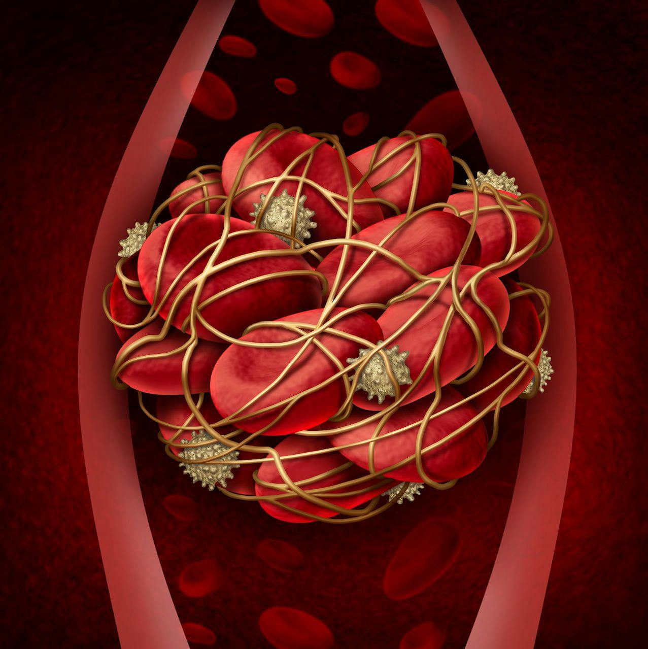 Persons Living With HIV Have a Higher Risk of Recurrent Blood Clots