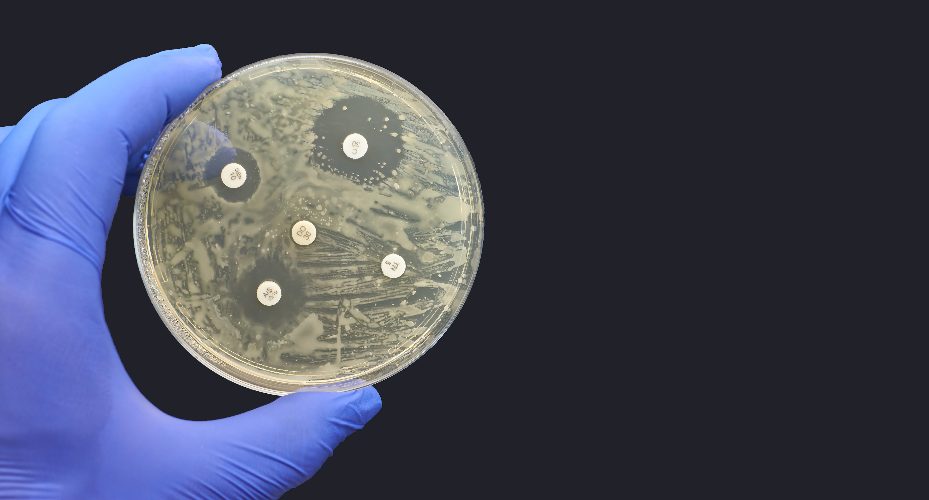 Kirby-Bauer Disk Diffusion Antimicrobial Susceptibility Test black background | © Nicolae Adobe Stock Image