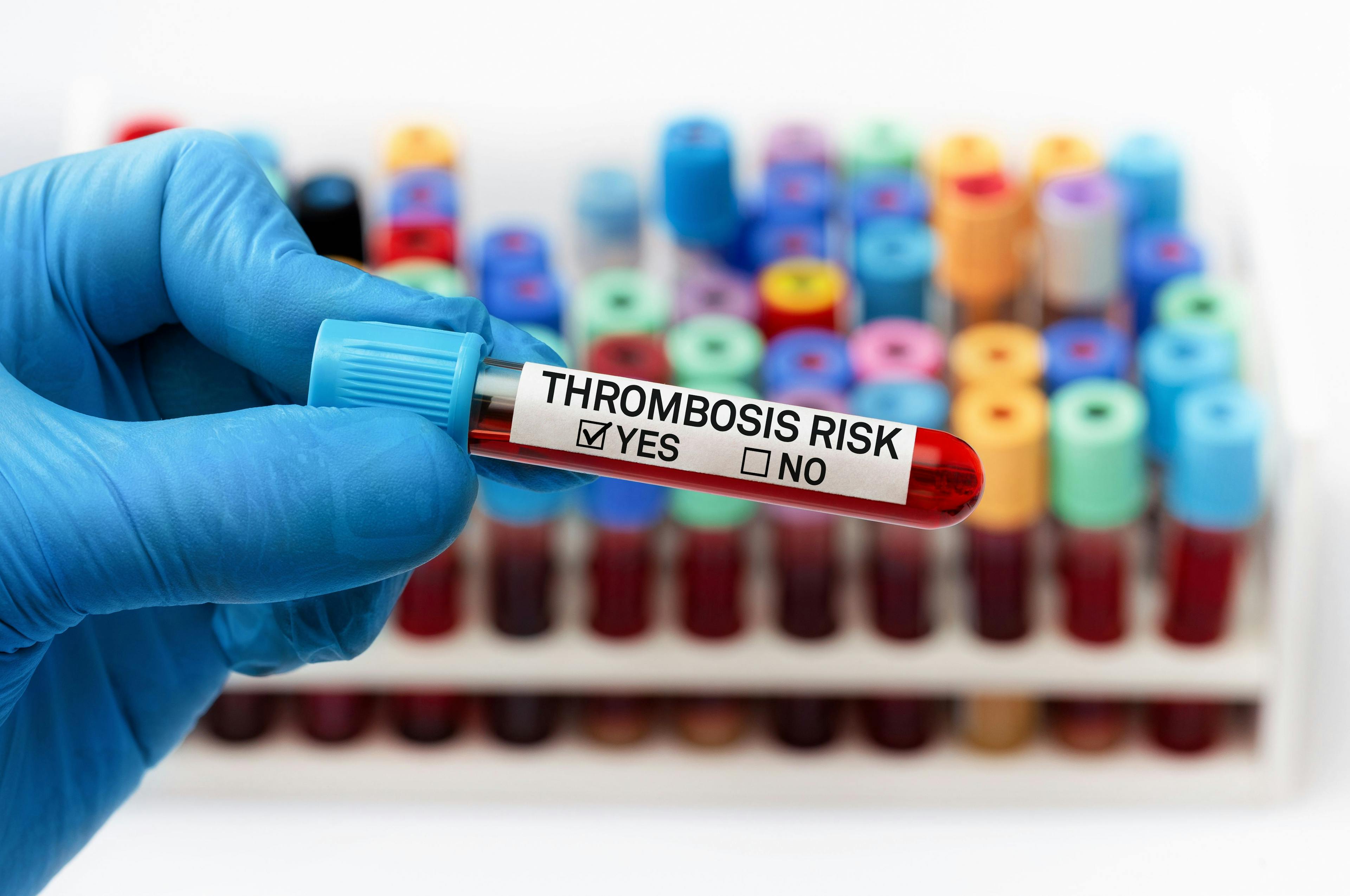 Blood sample test with positive diagnosis of thrombosis risk in a coagulation test | angellodeco - stock.adobe.com