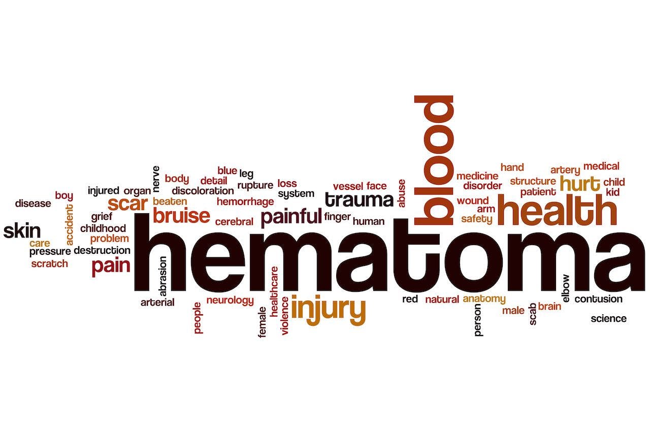 Hematoma word cloud: © ibreakstock - stock.adobe.com