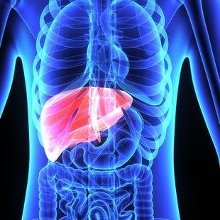 Obesity, Insulin Resistance Are Linked With Advanced Liver Fibrosis in Patients With Psoriasis