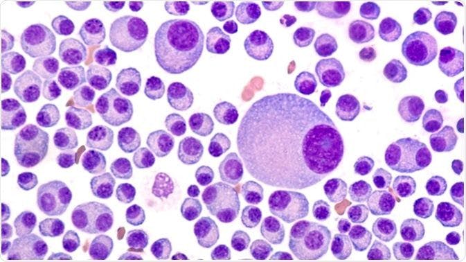 Unified Definition of "High-Risk" Is Needed for Multiple Myeloma Trials, Study Says