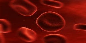 Frequency, Severity of Sickle Cell Crises Linked to Productivity Losses at Work