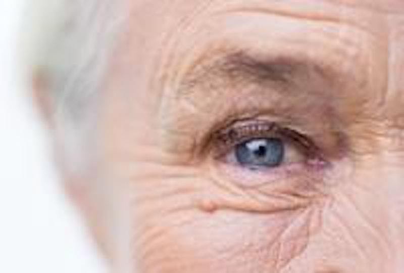 Elderly woman's eye.