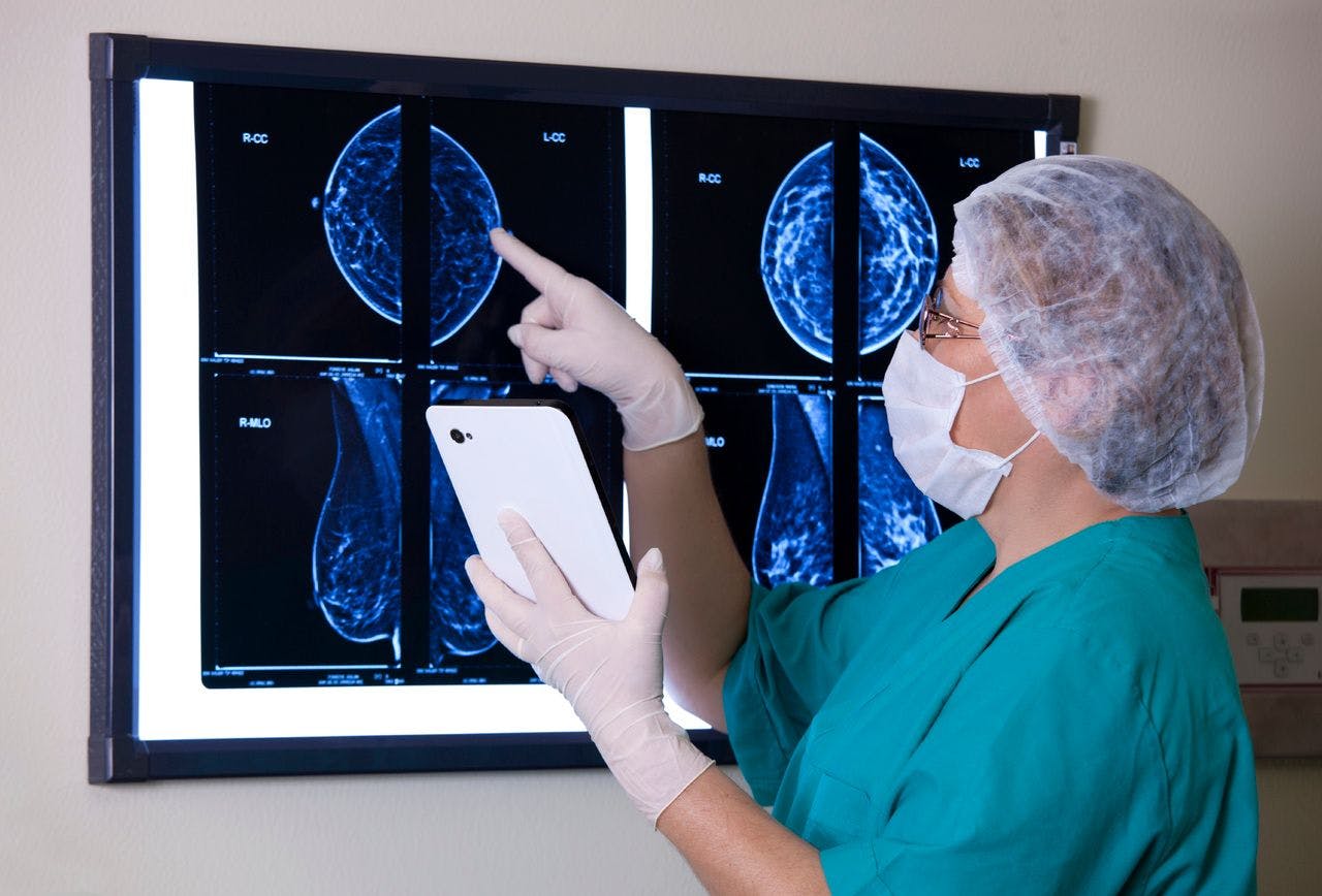 Interval Breast Cancer Found Within 1 Year Linked to Worse Mortality 