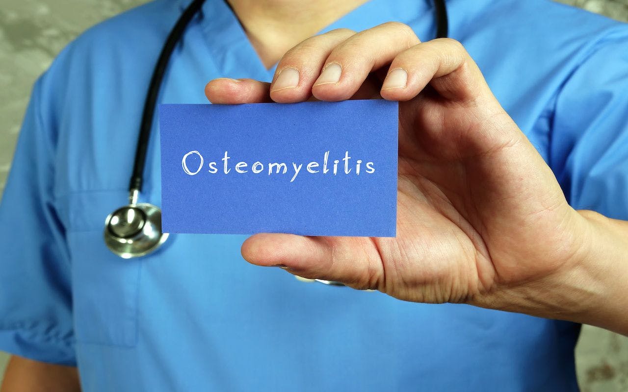Health care concept about Osteomyelitis with inscription on the sheet: © Yurii Kibalnik - stock.adobe.com