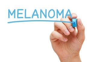 Image of the word "melanoma"