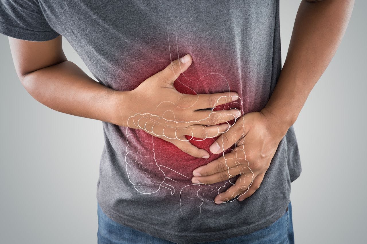Man with stomach pain illustrated by intestines image with red color | Image credit: eddows - stock.adobe.com