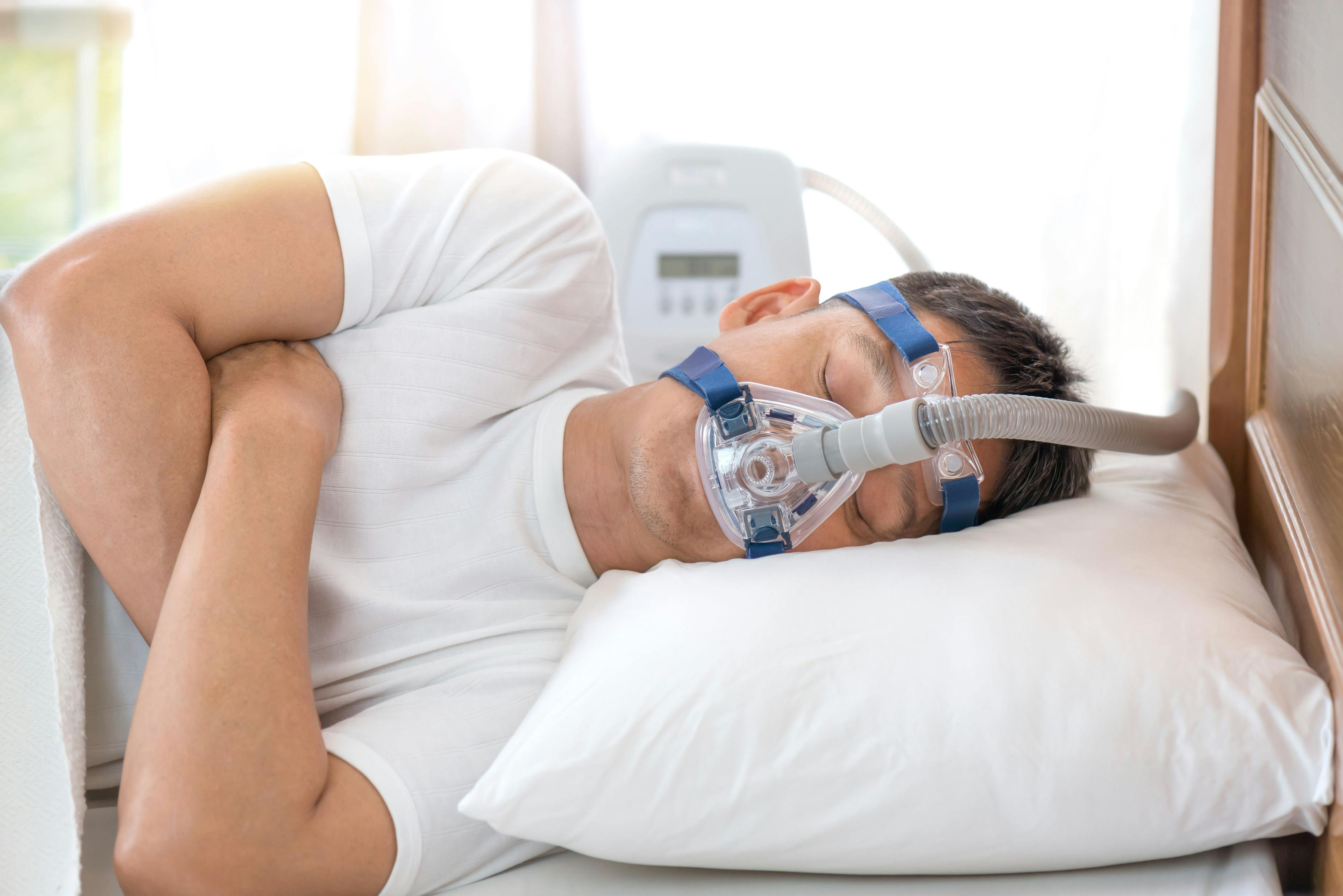 Man Sleeping With CPAP Mask for Sleep Apnea | image credit: sbw19 - stock.adobe.com