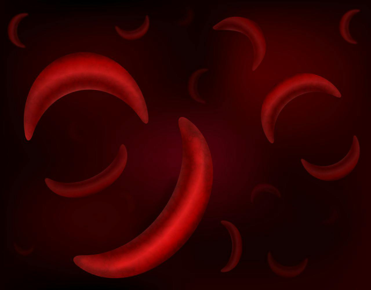 Patient Perception of Sickle Cell Care Differs by Acute vs Nonacute Settings
